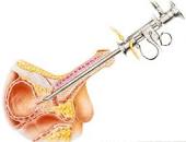 https://www.medicalnewstoday.com/articles/321190